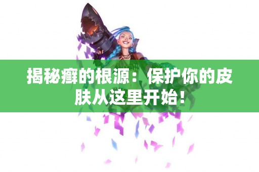 揭秘癣的根源：保护你的皮肤从这里开始！