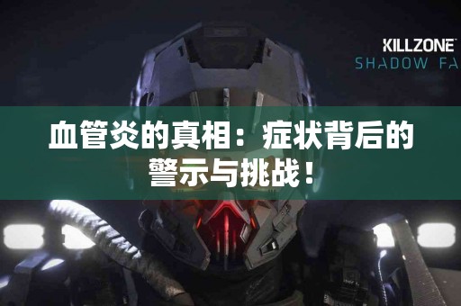 血管炎的真相：症状背后的警示与挑战！